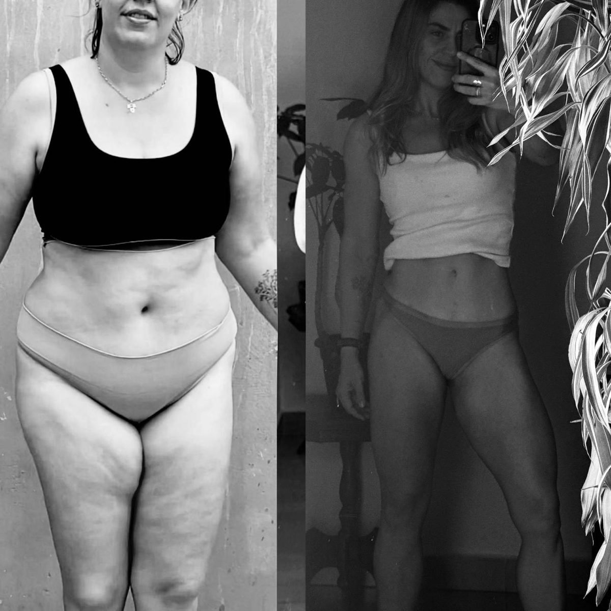 Antes e depois caso 01