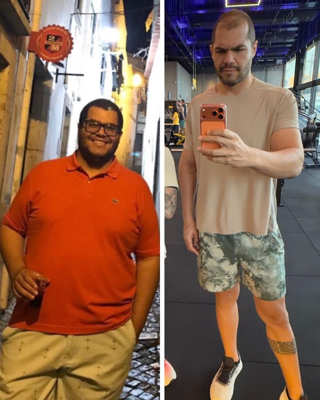 Antes e depois caso 04